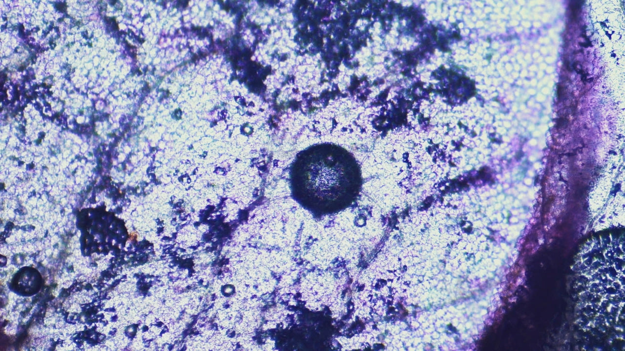 Gut Barrier Function: How the Microbiome Protects the Gut Lining