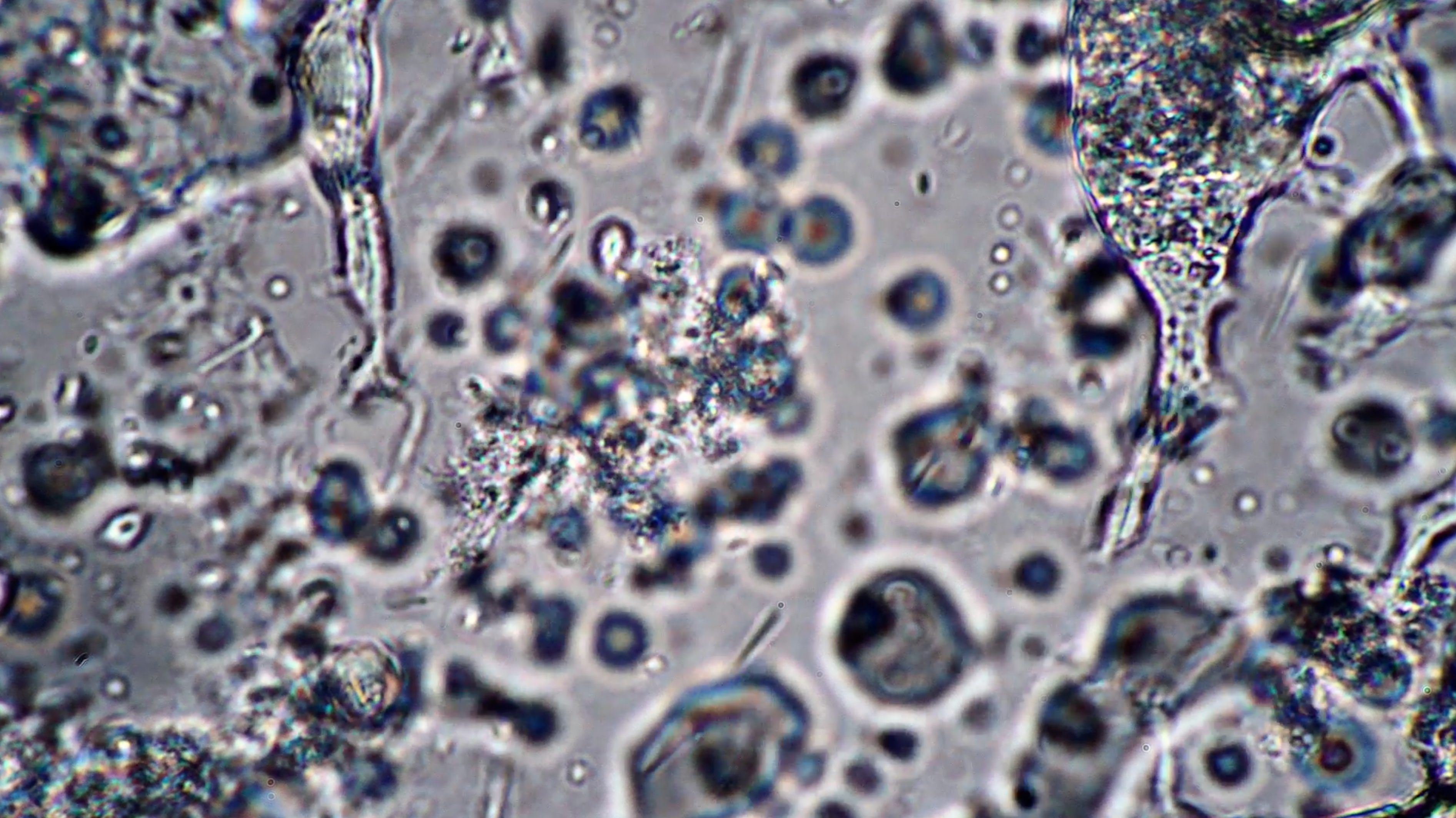 What Is Microbiome Diversity — and Why It Matters for Gut Health